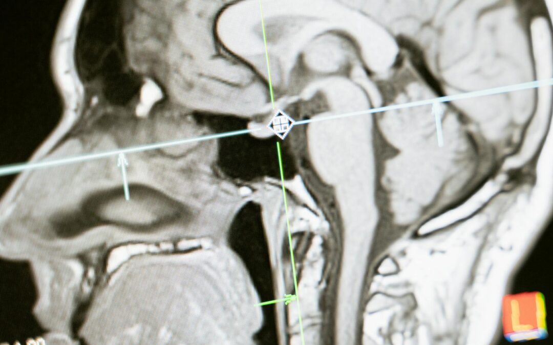 Unveiling the Power of AI in Healthcare: A Case Study in Medical Imaging